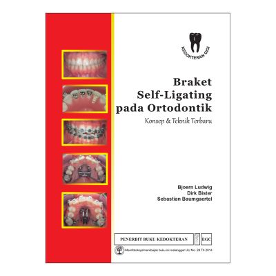 Braket Self-Ligating pada Ortodontik Konsep & Teknik Terbaru