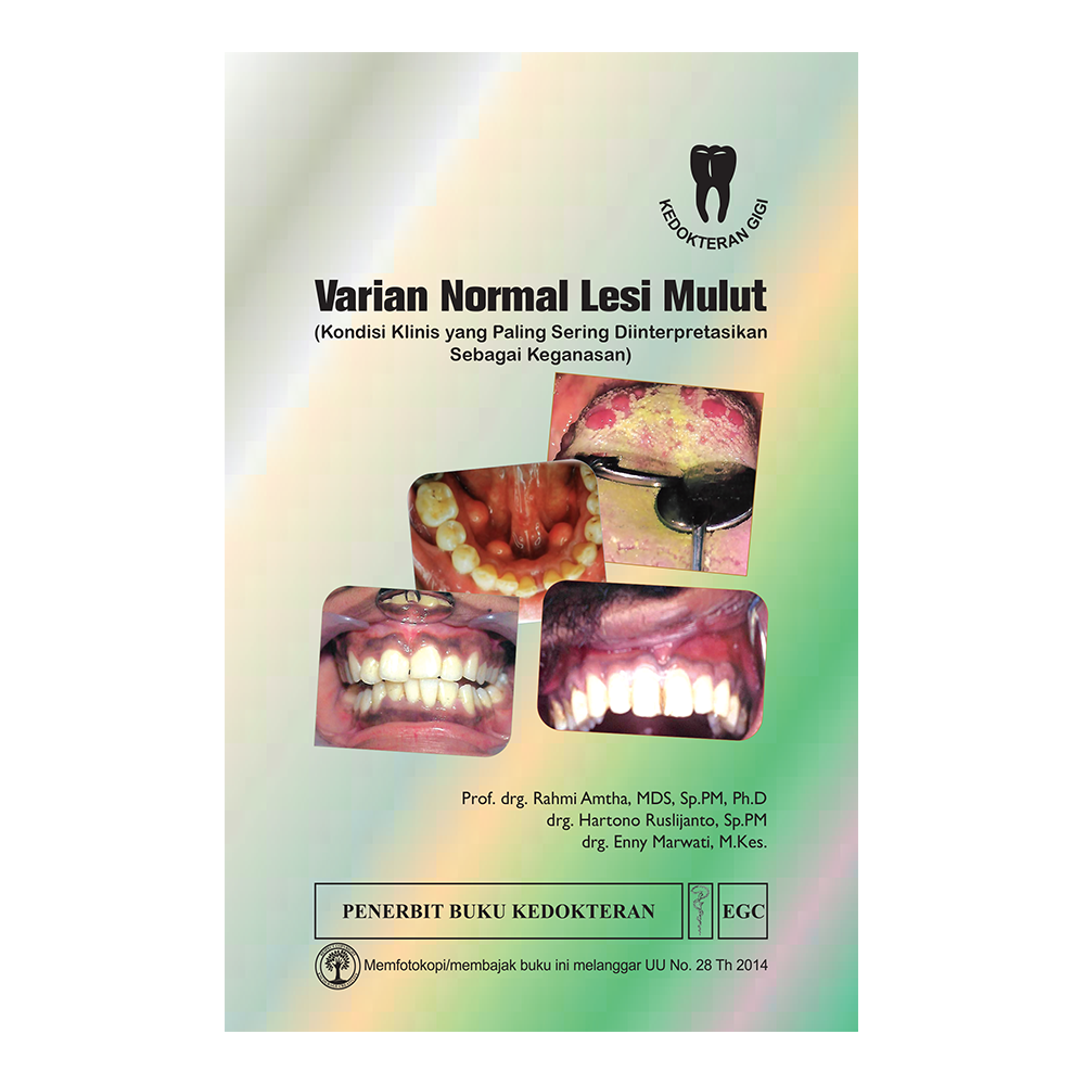 Varian Normal Lesi Mulut
