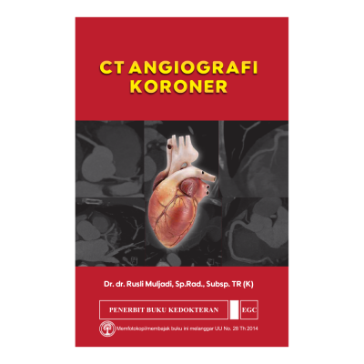 CT Angiografi Koroner