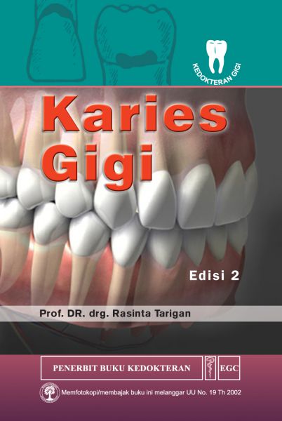 Karies Gigi Ed.2