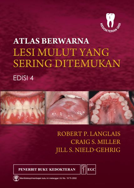 Atlas Berwarna Lesi Mulut yang Sering Ditemukan Ed.4
