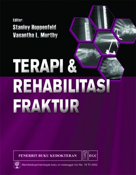 Terapi & Rehabilitasi Fraktur 